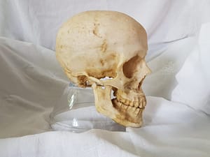 jaw pain